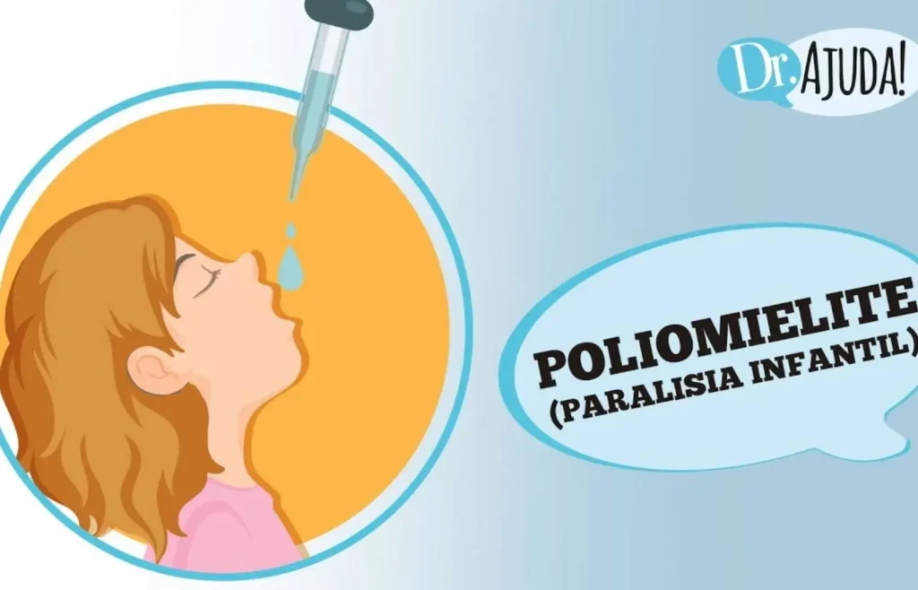 A Importância da Vacinação Contra a Poliomielite: Protegendo o Futuro das Crianças