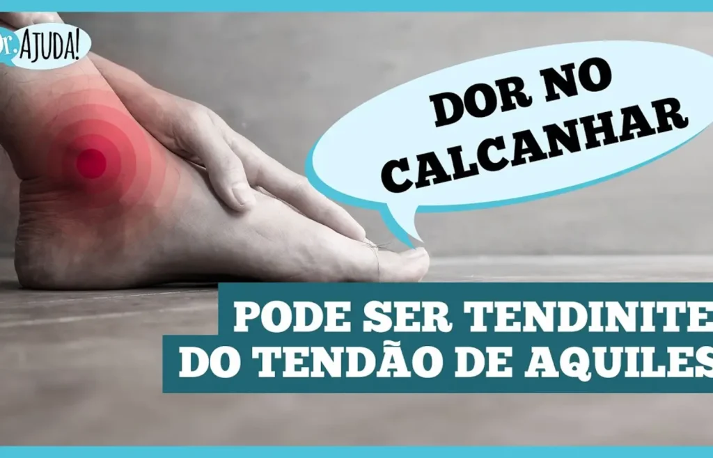 Sofrendo com dor no calcanhar? Entenda a tendinite do tendão de Aquiles