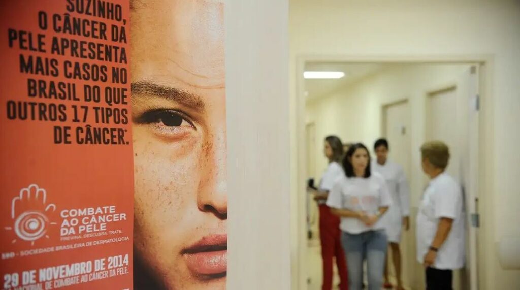 Câncer de Pele: Crescimento Alarmante de Casos no Brasil nos Últimos 10 Anos