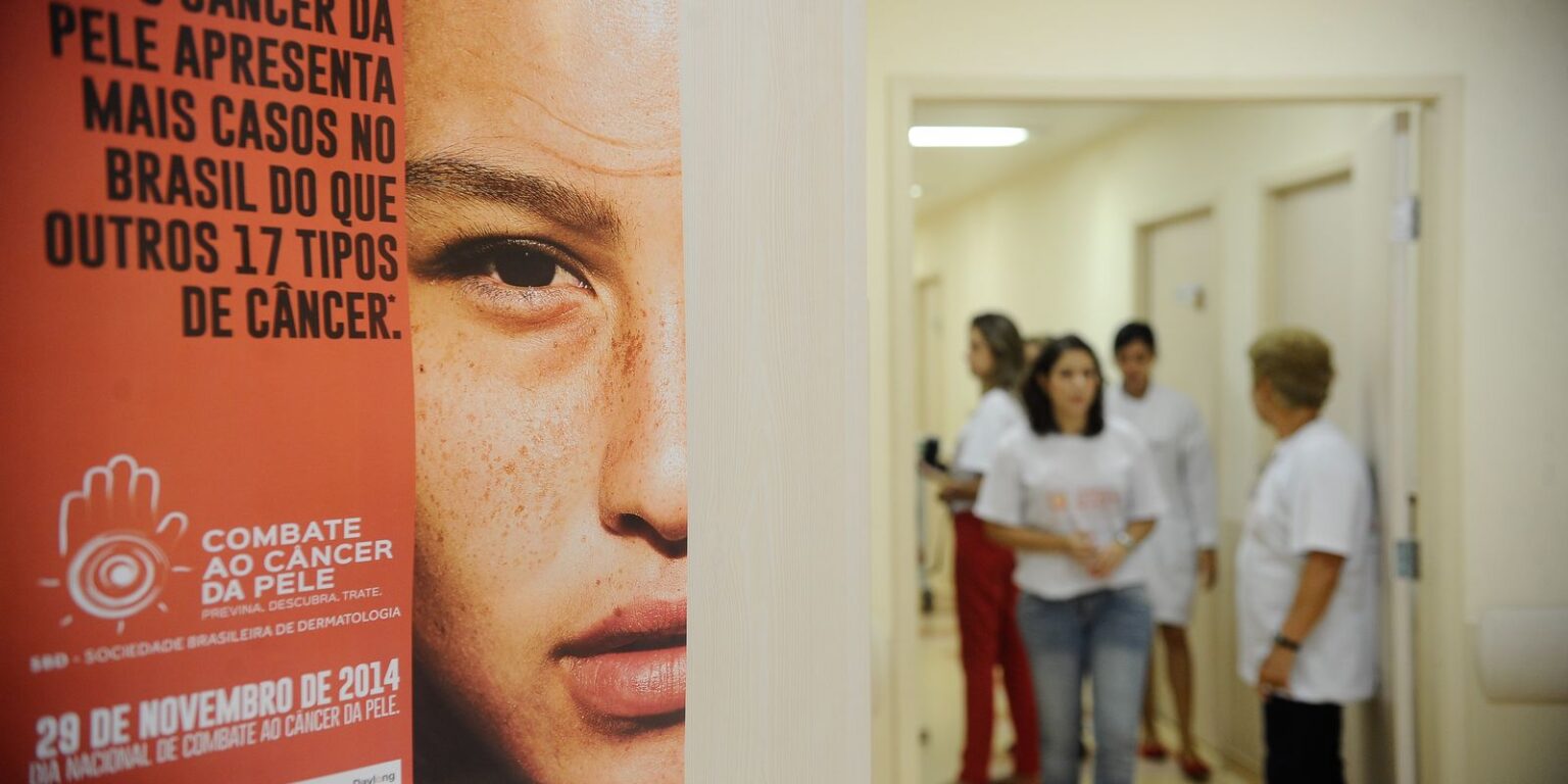 Câncer de Pele no Brasil: Aumento de Casos Salta para Mais de 72 Mil em 10 Anos Câncer de Pele no Brasil: Aumento de Casos Salta para Mais de 72 Mil em 10 Anos