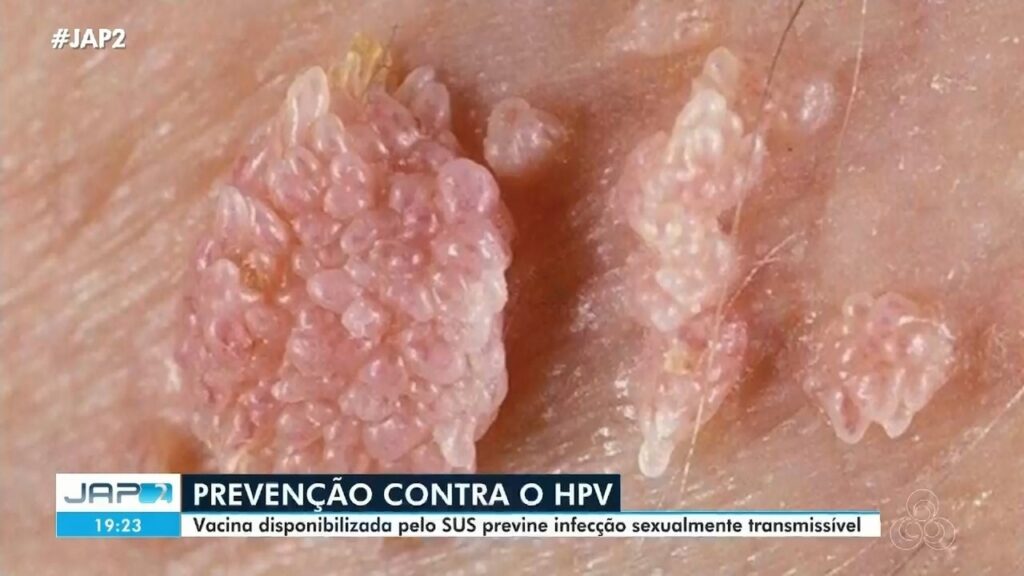 Carreta Delas: Consultas e Exames Gratuitos na Zona Sul de Macapá