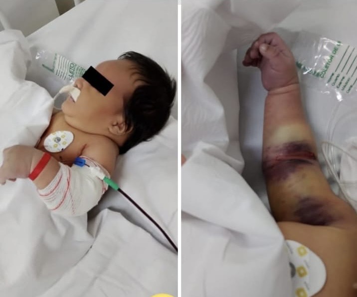 Urgência do Protocolo Benício Xavier em Debate Após Caso de Bebê com Condições Especiais