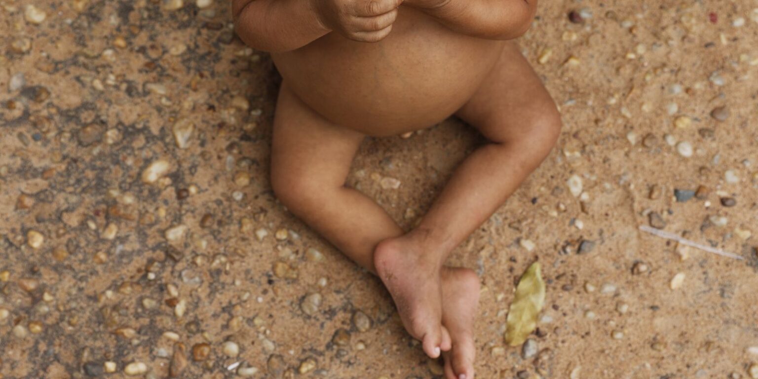 Vulnerabilidade Social Reduz Altura de Crianças Indígenas e Nordestinas no Brasil