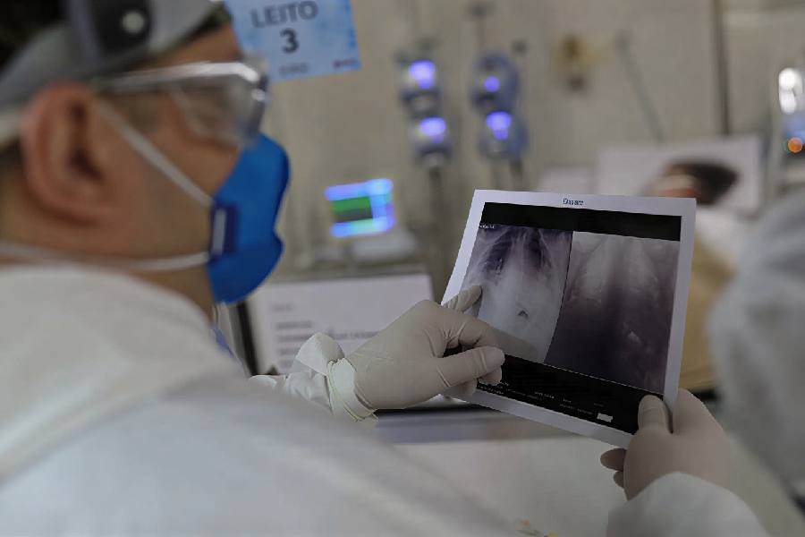 Infecções Respiratórias em Alta no Brasil: Alerta para Hospitais e Autoridades