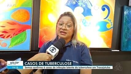 Seis Casos de Tuberculose Latente Confirmados em Comunidade Rural de Macapá